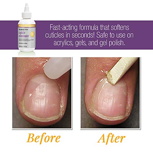 3 ProLinc+Cuticle+Eliminator+Fluid+Ounce