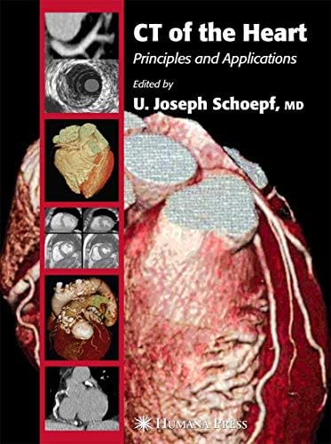 Atlas of Nuclear Cardiology: Dilsizian, Vasken, Narula, Jagat