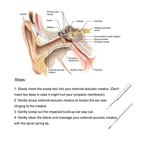 Ear Wax Pick Remover Curette for Build Up Impacted Earwax, Medical