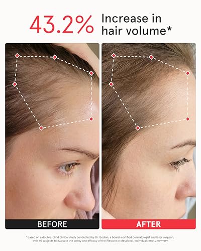 iRestore Professional Laser Hair Growth System-FDA Cleared Laser Cap Hair Growth for Men & Hair Regrowth Treatments for Women, Hair Loss Treatments Hair Cap, Like Laser Comb for Hair Growth Products