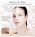 Cloud 9 Whitening SET (Cream 50ml + Serum 30ml, Total 2pcs)