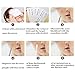 Blackhead and Acne Removal Tool,Best Pimple Extractor Kit to Remover Comedone and Blemish without Risk for Sensitive Skin by Fairyland(100 Cotton Pads + Magnifier)