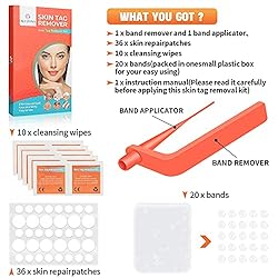 Painless Safe Skin Tag Remover Device Kit Micro