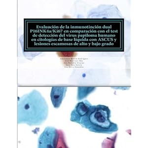 EVALUACION DE LA INMUNOTINCION DUAL P16INK4a/Ki67 EN COMPARACION CON EL TEST DEL VIRUS DEL PAPILOMA HUMANO EN CITOLOGIAS DE BASE LIQUIDA CON ASCUS Y .