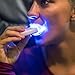 Stardust Home Teeth Whitening Kit, Accelerator LED Light, 2-in-1 Gel Syringes Made in USA, Dentist Designed