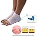 AYAOQIANG Gel Heel Socks Open Toe Socks for Dry Hard Cracked Skin Moisturizing Day Night Care Skin,Gel to Heal Dry Cracked Heels -2 Pair(Pink and Green)