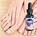FungiAid - Nail Fungus Treatment with Pure Essential Oils - Promotes Stronger and Healthier Nails 1 oz / 30 ml