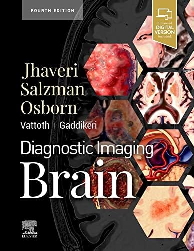 ExpertDDx: Brain and Spine: 9780443106941: Medicine & Health