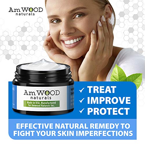 Acne Spot Treatment Cream - Made in USA - Fast-Acting Formula for Clearing Severe Acne from Face & Body - Effective & Invisible Cystic Acne Cleanser Solution for Teens & Adults