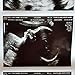 Customized 2D PRANK Pregnancy Ultrasound Sonogram Test - Photo Strip of 3 photos