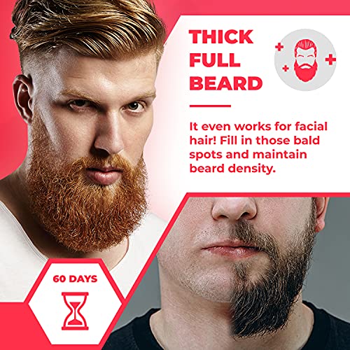 Regenivade Men's 5 Minoxidil Plus Topical Solution (3 Month Supply) Hair Regrowth Treatment