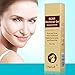 Scar Cream, Acne Scar Removal Cream,Acne Spots Treatment,Stretch Marks Relief and Burns Repair,Face Skin Repair Cream 30ml