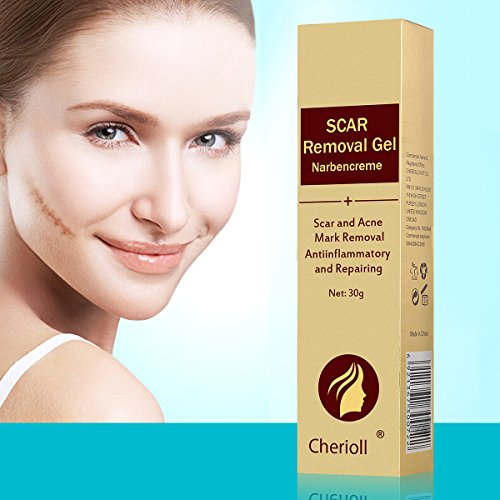 Scar Cream, Acne Scar Removal Cream, Face Skin Repair Cream, Acne Spots