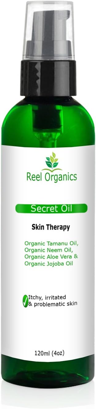 Secret Oil - Skin Therapy | Best Treatment for Psoriasis, Eczema, Acne Scar, Foot Fungus, Rosarea. (4 oz)