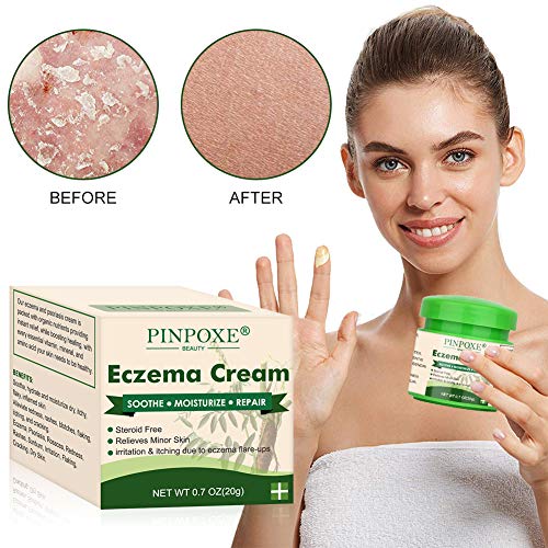 Eczema Cream, Eczema Therapy, Psoriasis Cream for Dry, Irritated Skin