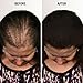 Infinity Hair Building Fibers Hair Loss Concealer for Thinning Hair & Hair Loss for Women & Men Appearance Of Thicker, Fuller Hair In 30 Seconds Kit, Dark Brown