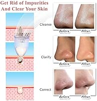 voibella pore vacuum