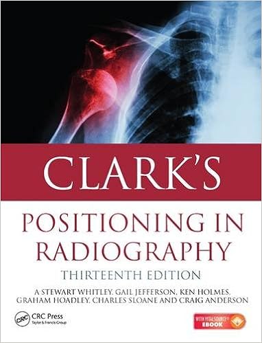 Image result for clarks positioning in radiography