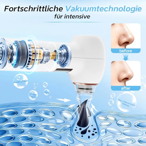 Blackhead Remover Pore Cleaner 3 Modes Vacuum Facial Cleansing White | 5 attachments pimple sucker, USB-C charging, portable pore vacuum cleaner, including pimple tool set