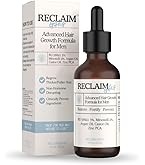 Amazon.com : Vantanex RU-58841 8% Extra Strength Topical Hair