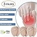 Metatarsal Pads Ball of Foot Cushions (6PCS) - Forefoot Cushions Shoe Inserts for Man & Women - Insoles for Ball of Foot Pain - Pain Relief for Metatarsalgia Morton Neuroma Calluses