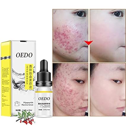 oedo skin care