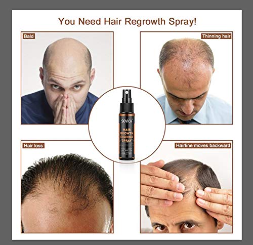 Hair Regrowth Spray, Anti Hair Loss, Thinning, Balding, Natural Ingredients Hair Regrowth Treatment for Stronger, Thicker, Longer Hair Grow,Repair Hair Follicles, All Hair Types, Men and Women