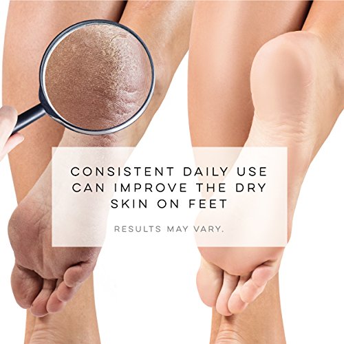 LE EMILIE 5 Toe Moisturizing Gel Socks Perfect for Healing Dry Cracked Heels and Feet