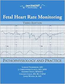 fetal heart monitor amazon
