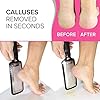 ULTIMATE-Foot-File-Hard-Skin-Remover-BEST-Foot-Files-for-Hard-Skin-Feet-Hard-Skin-Remover-GENUINE-MEGAFILE-Pedicure-Callus-Remover-Rasp-Heel-Peel-Egg-Foot-Scrubber-Pumice-Stone-for-Feet-Ped-Pedi Ultimate Pedicure Foot File Foot Scraper Hard Skin Remover Foot Files for Hard Skin (Large) NYK1 MEGAFILE Dead Skin…