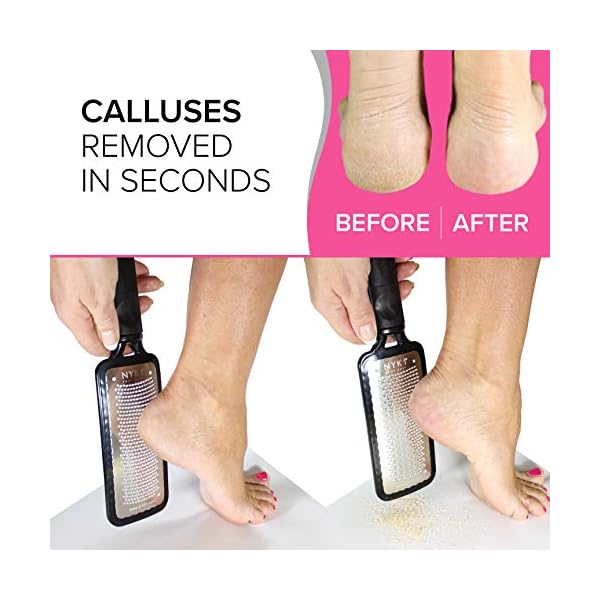 ULTIMATE-Foot-File-Hard-Skin-Remover-BEST-Foot-Files-for-Hard-Skin-Feet-Hard-Skin-Remover-GENUINE-MEGAFILE-Pedicure-Callus-Remover-Rasp-Heel-Peel-Egg-Foot-Scrubber-Pumice-Stone-for-Feet-Ped-Pedi Ultimate Pedicure Foot File Foot Scraper Hard Skin Remover Foot Files for Hard Skin (Large) NYK1 MEGAFILE Dead Skin…