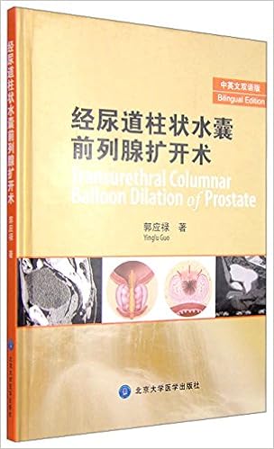 经尿道前列腺扩开术 15年中英文双语版 郭应禄 Amazon Com Books