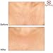 Alycia Beauty Decollete Chest Pad for Women – 2 Pack Reusable Anti Wrinkle Silicone decolette Pads - Wrinkle Prevention - Preventer for Breast Wrinkles Caused by Sun, Sleep or Aging – incl Exfoliator