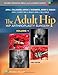 The Adult Hip (Two Volume Set): Hip Arthroplasty Surgery