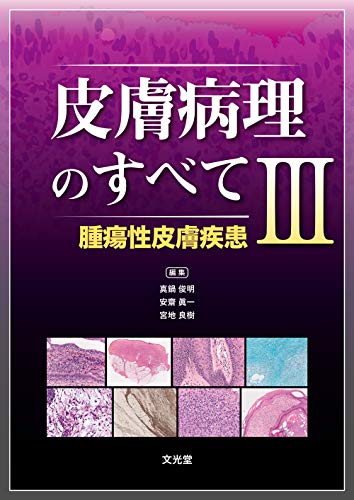 皮膚病理のすべて Iii 腫瘍性皮膚疾患 Parapentefamily Com
