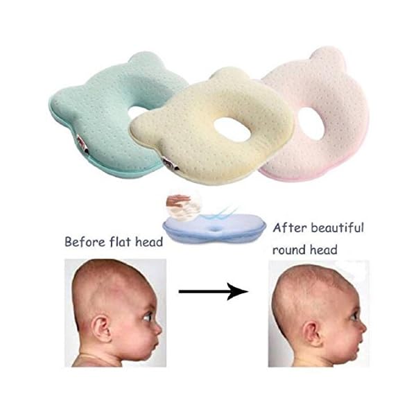 newborn flat head prevention