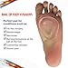 Metatarsal Pad Ball of Foot Cushions Pads 2018 UPGRADE Sticking to Shoes for Mortons Neuroma Foot Gel Pad Pain Relief Metatarsalgia Callus Bunion Insoles High Heels Metatarsal Pads for Feet Women Men