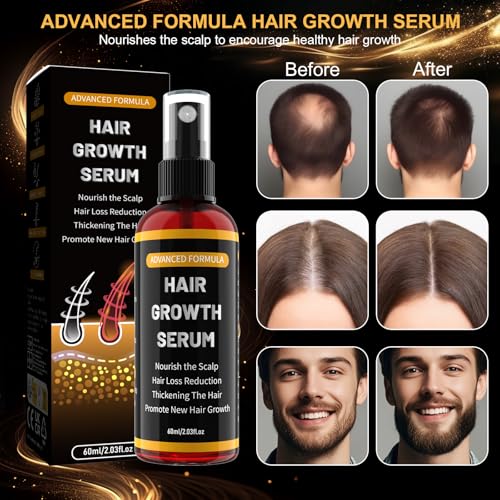 Hair Growth Serum Spray for Men/Women to Accelerate Hair Growth Prevent Hair Loss with Biotin and Rosemary for Hair Growth Oil, Hair Growth Oil