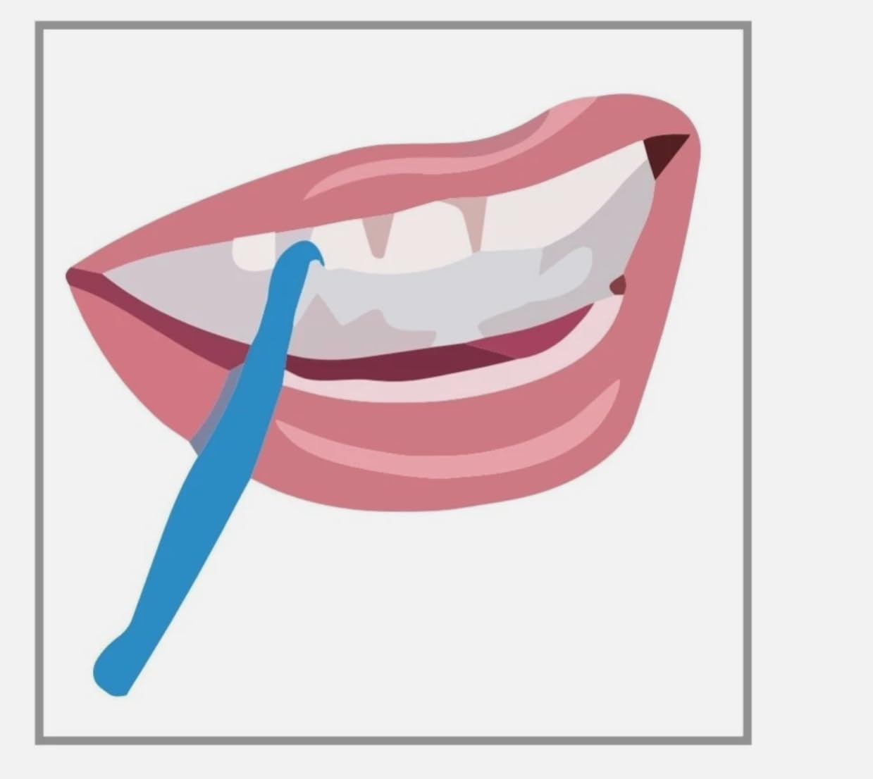 Orthodontic Aligner Retainer Retriever Plastic 3 Pack