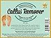 4 oz Callus Remover, with pumice stone. Callus Eliminator,Liquid & Gel For Corn And Callus On Feet. Professional Grade