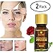 ALIVER Ultra Brightening Spotless Oil, Dark Spots Removal Age Spots Hyper-Pigmentation, Skin Care Stretch Marks, Skin Whitening Brightening, 2 Pack