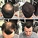 Hair Cubed® - Light Brown, Hair Building Fiber Spray -(Water Proof) Lasts 2 - 5 Months