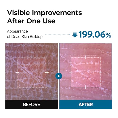 Dr.Melaxin Tranexamic Acid Body Exfoliating Spray – Brightening Treatment with Niacinamide for Uneven Skin Tone & Smooth Skin, 200ml