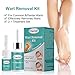 Wart Remover, Plantar Wart Removal, Corn Callus Remover, Wart Removal with Natural Ingredients, Stops Wart Regrowththumb 1