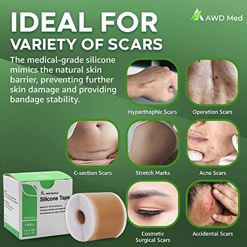 AWD Silicone Scar Tape for Surgical Scars Medical Grade Silicone Scar Sheets for C Section