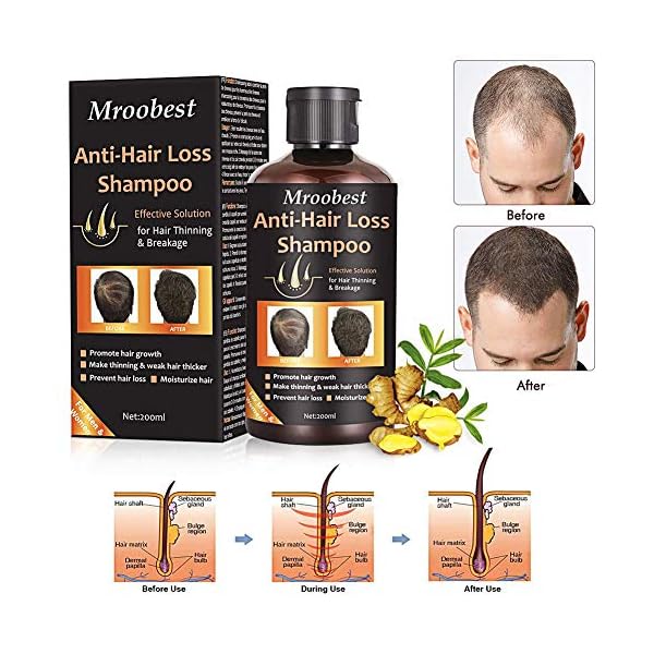 Anti-Hair Loss Shampoo, Hair Growth Shampoo, Effective Solution for Hair Thinning & Breakage, Helps Stop Hair Loss, Grow…