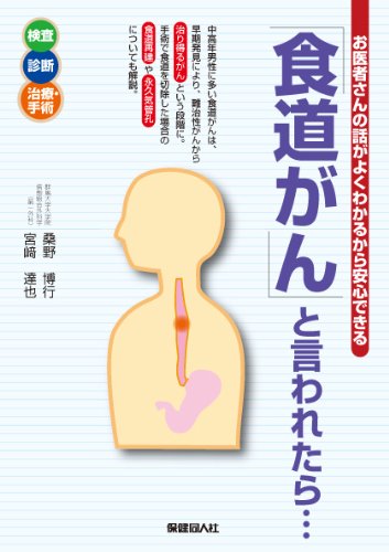 食道がん」と言われたらu2026u2015お医者さんの話がよくわかるから安心できる 
