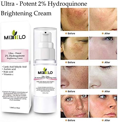 hydroquinone bleaching cream