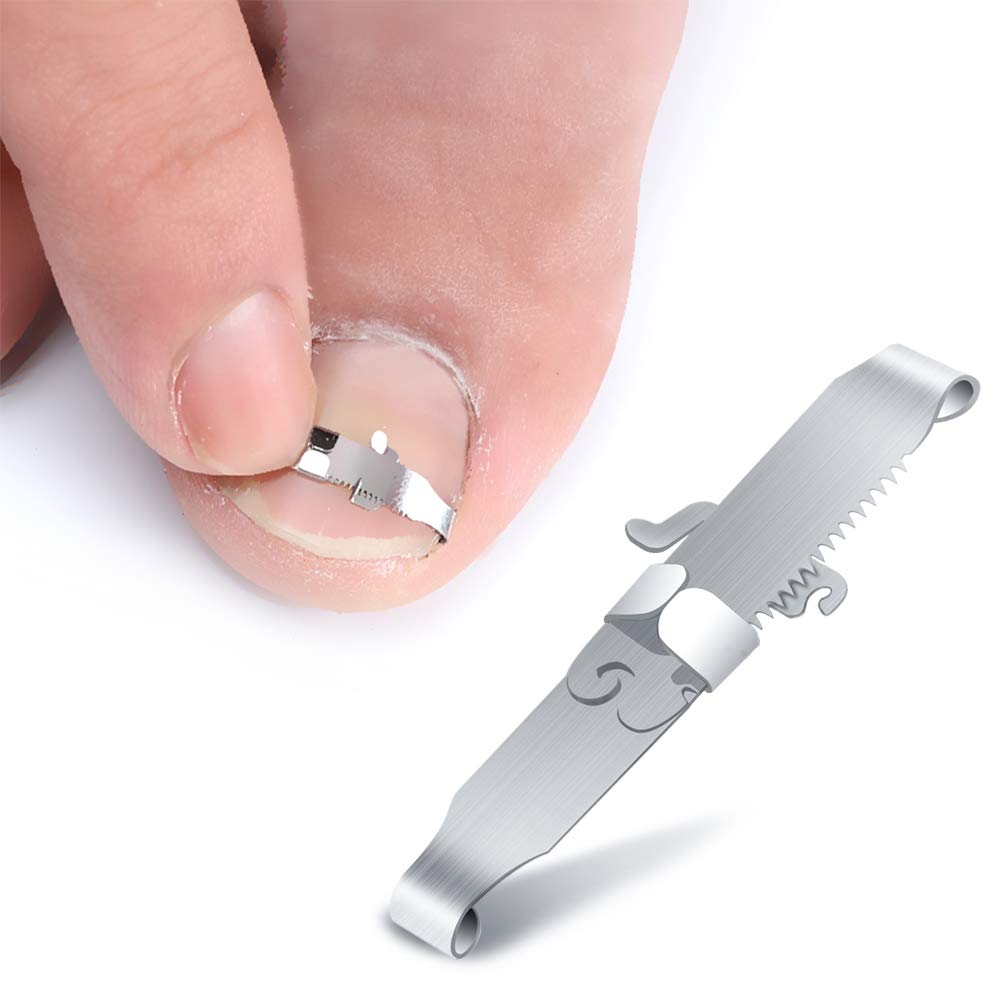 BEZOX Ingrown Toenail Tools, 2PCS Ingrown Toenail