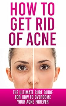 Amazon.com: How to Get Rid of Acne: The Ultimate Cure Guide for How to Overcome Your Acne ...